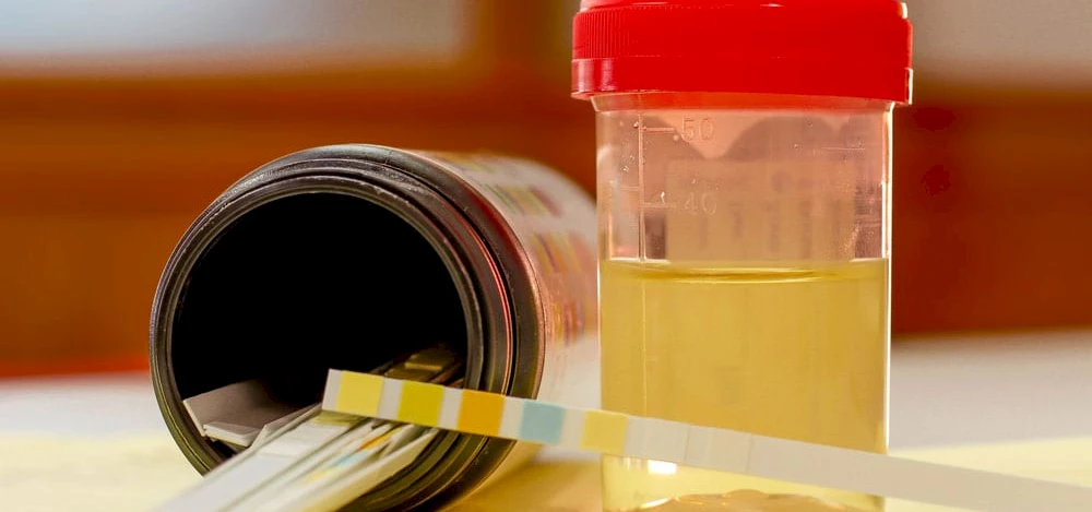 Weekend Roundup: Drug Test Cheaters, Naloxone News, and Amazon Recruiting