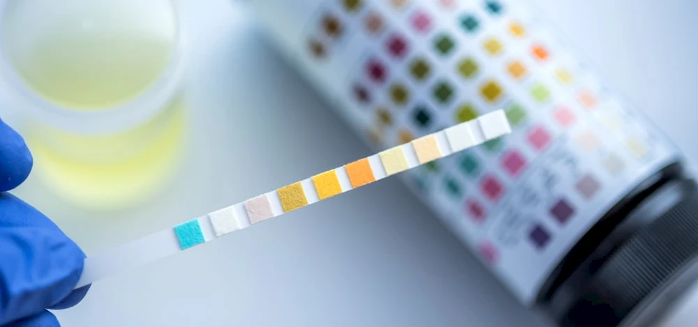 5 Legal Implications of Drug Testing at Your Small Business