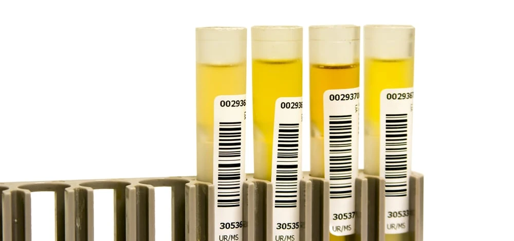 Why Employees in Texas Test Positive for Drugs More Often