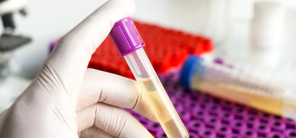 Oil and Gas Drug Testing: An HR Compliance Guide