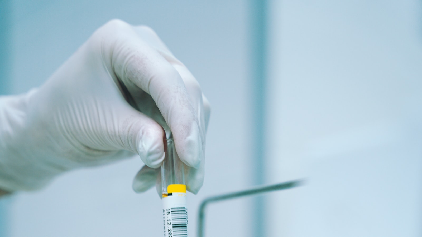 Gloved hand holding a specimen tube for a workplace drug test