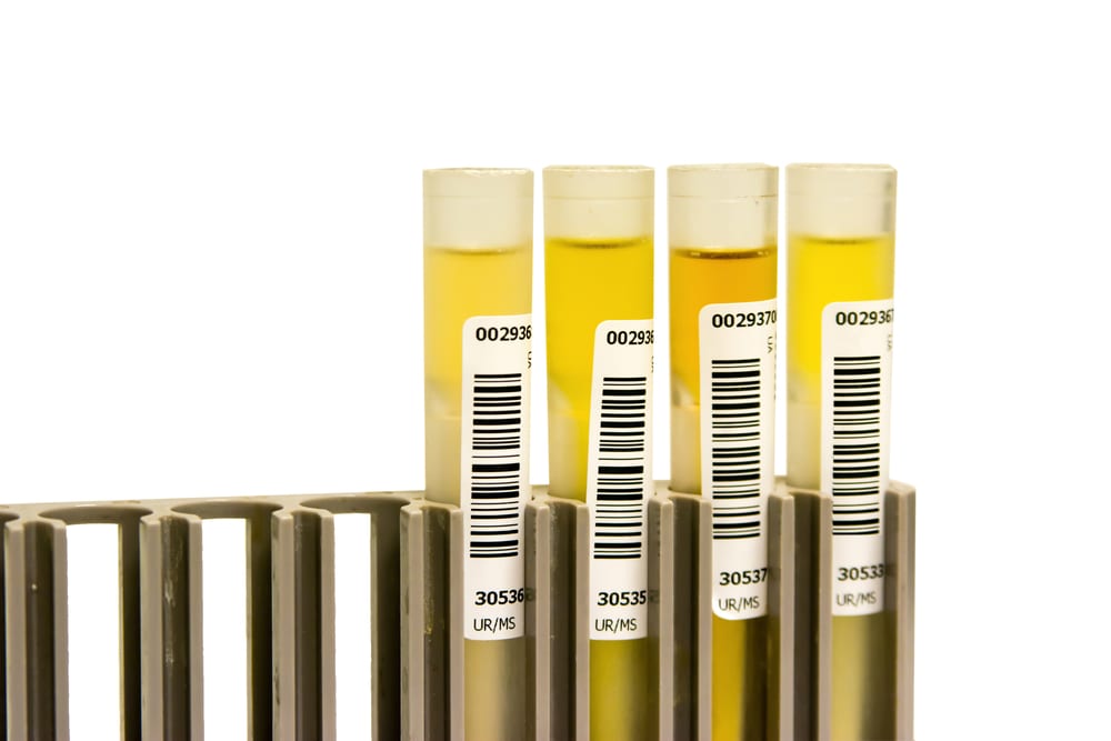 lab urine samples