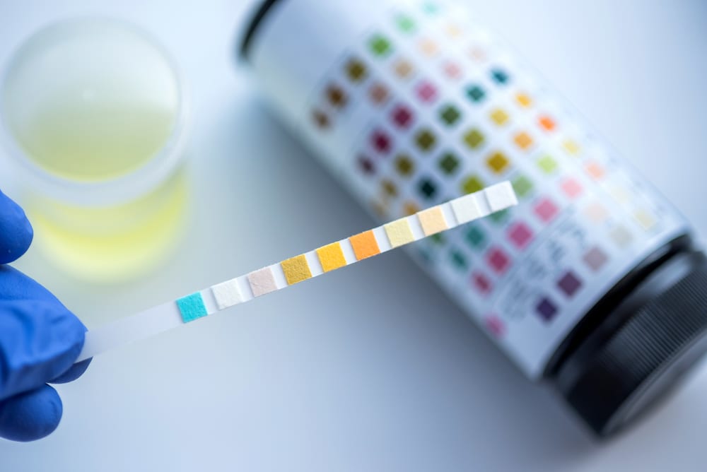 5 Legal Implications of Drug Testing at Your Small Business