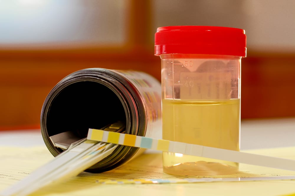 Weekend Roundup: Drug Test Cheaters, Naloxone News, and Amazon Recruiting