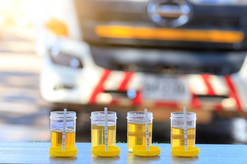 driver drug test urinalysis
